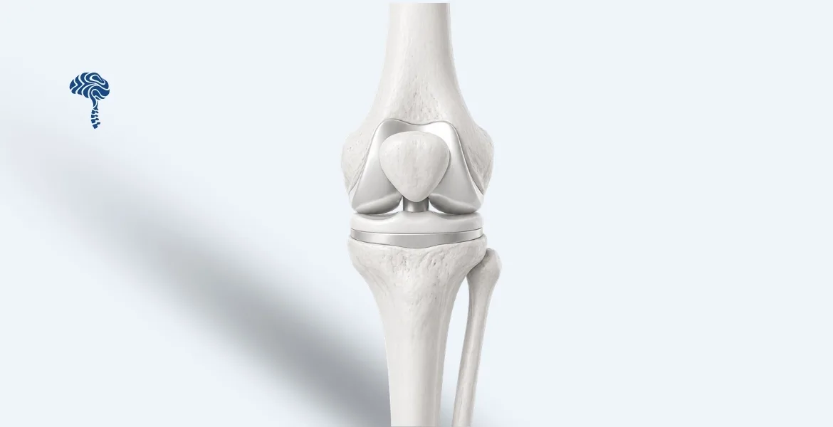 Best Joint Replacement (Knee, Shoulder & Elbow) Hospital in Kurnool