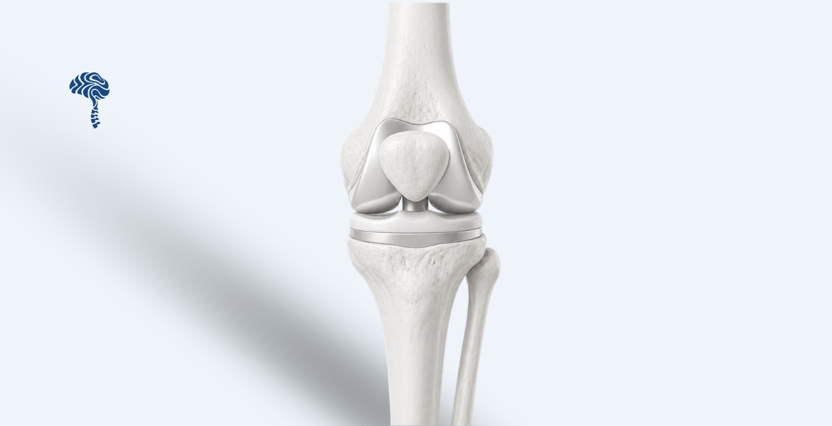 Joint Replacement (Knee, Shoulder & Elbow)