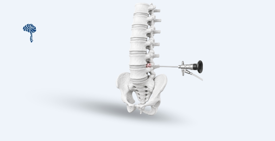 Spine Surgery