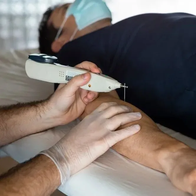 Physiotherapist performing Dry Needling Therapy for muscle pain and trigger point release at Wellnest Physio & Rehabilitation Centre in Kurnool.